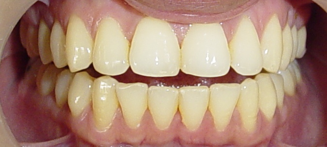 before click on pic to enlarge